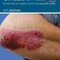 Clinical Dermatology, 5th Edition 2015