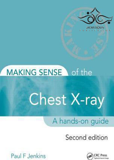 Making Sense of the Chest X-ray: A hands-on guide, 2nd Edition2013 ساختن حس اشعه ایکس قفسه سینه: یک راهنمای عملی