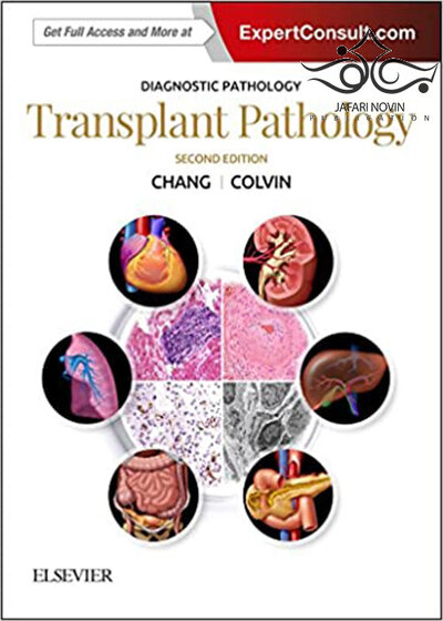 Diagnostic Pathology: Transplant Pathology, 2nd Edition 2018