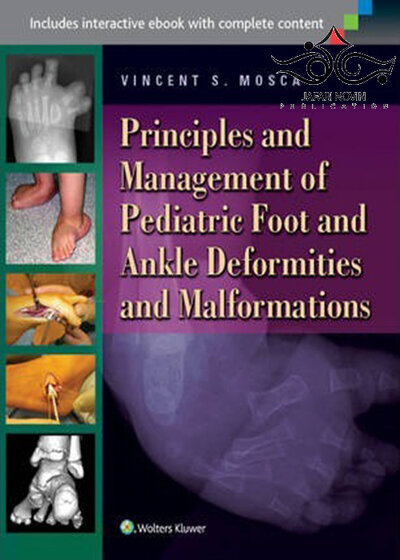 Principles and Management of Pediatric Foot and Ankle Deformities and Malformations2014 اصول و مدیریت ناهنجاری ها و ناهنجاری های پا و مچ پا در کودکان