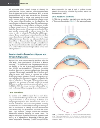 Refractive Surgery, 3rd Edition2019