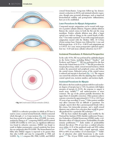 Refractive Surgery, 3rd Edition2019