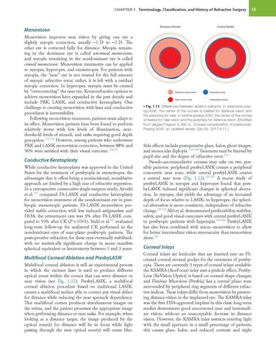 Refractive Surgery, 3rd Edition2019