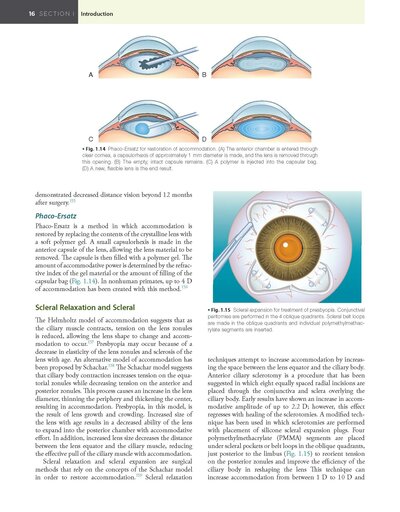 Refractive Surgery, 3rd Edition2019