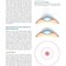 Refractive Surgery, 3rd Edition2019