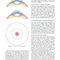 Refractive Surgery, 3rd Edition2019
