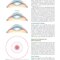 Refractive Surgery, 3rd Edition2019