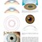 Refractive Surgery, 3rd Edition2019