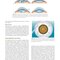 Refractive Surgery, 3rd Edition2019