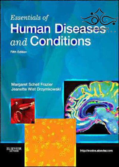 Essentials of Human Diseases and Conditions 5th Edition2012