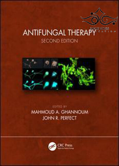 Antifungal Therapy 2nd Edition, Kindle Edition2019 ضد قارچ درمانی نسخه دوم ، نسخه کیندل