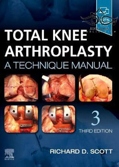 Total Knee Arthroplasty 3rd Edition2019 آرتروپلاستی کامل زانو