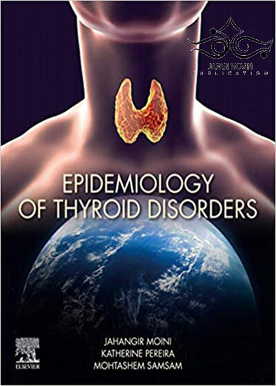 Epidemiology of Thyroid Disorders 1st Edition2020 اپیدمیولوژی اختلالات تیروئید