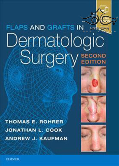 Flaps and Grafts in Dermatologic Surgery 2nd Edition2017