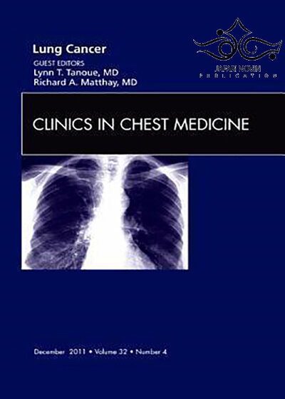 Lung Cancer (Volume 32-4), 1st Edition2011 سرطان ریه (جلد 32-4)