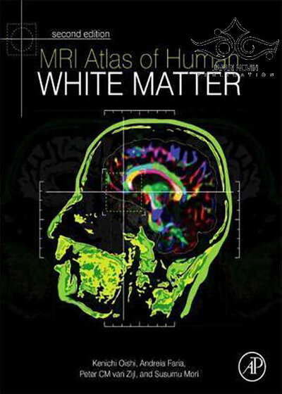 MRI Atlas of Human White Matter, 2nd Edition2010 اطلس ماده سفید انسان