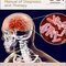 Tuberculous-Meningitis2020 مننژیت سل