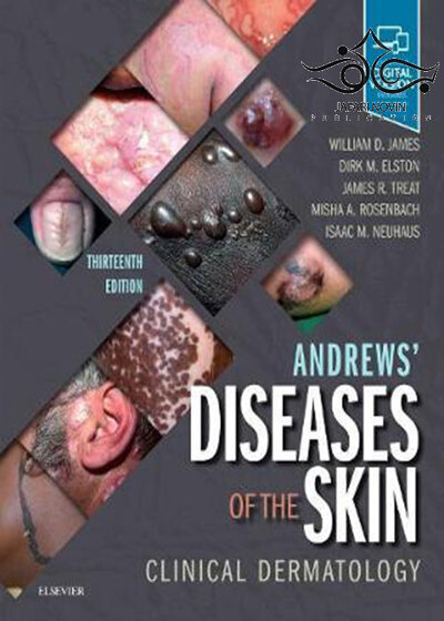 Andrews' Diseases of the Skin : Clinical Dermatology2019