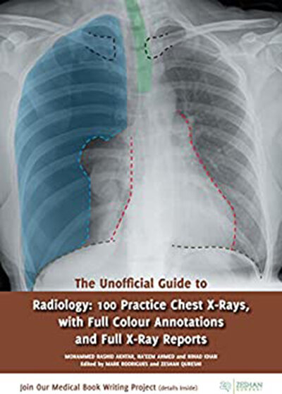 The Unofficial Guide to Radiology2017