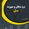 درد دهان و صورت بل