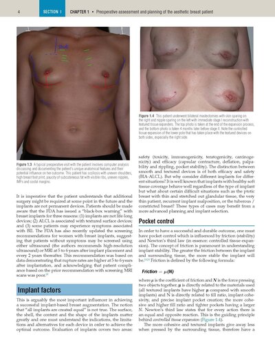 Plastic Surgery Neligan Volume 5: Breast 5th Edition 2023