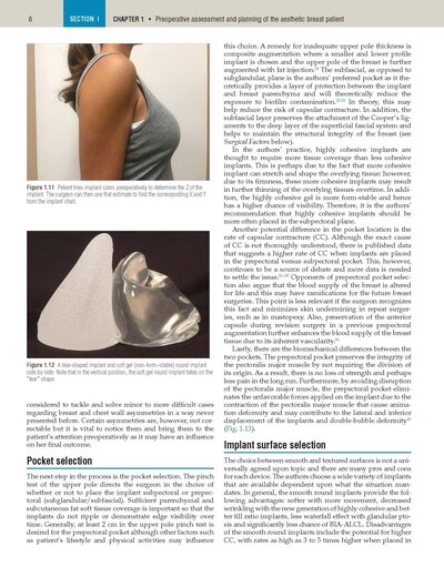 Plastic Surgery Neligan Volume 5: Breast 5th Edition 2023