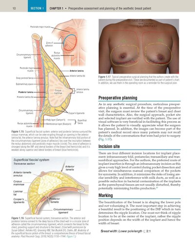 Plastic Surgery Neligan Volume 5: Breast 5th Edition 2023