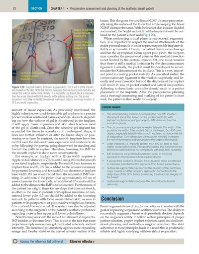 Plastic Surgery Neligan Volume 5: Breast 5th Edition 2023