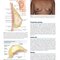 Plastic Surgery Neligan Volume 5: Breast 5th Edition 2023