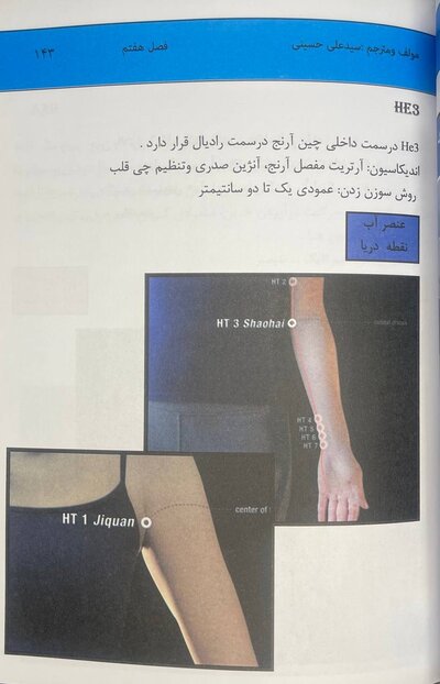 اولین مرجع طب سوزنی بدن 2022