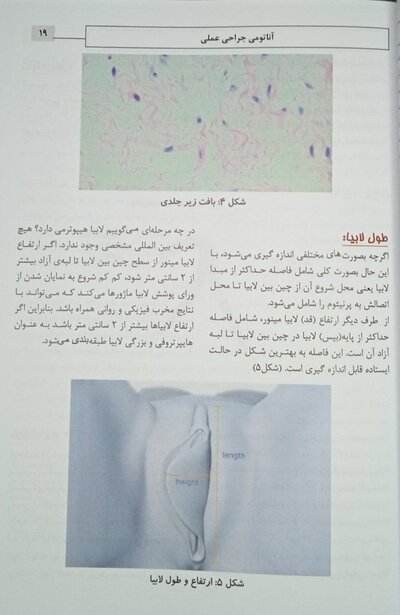 لابیاپلاستی کاربردی