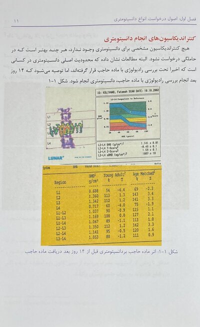 سنجش تراکم استخوان (دانسیتومتری)