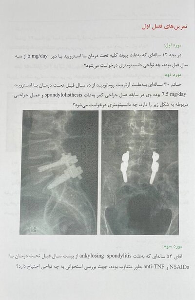 سنجش تراکم استخوان (دانسیتومتری)
