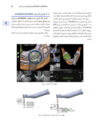 اصول جراحی دهان، فک و صورت پیترسون 2022 - جلد اول