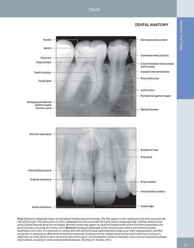 Diagnostic Imaging: Oral and Maxillofacial 3rd Edition
