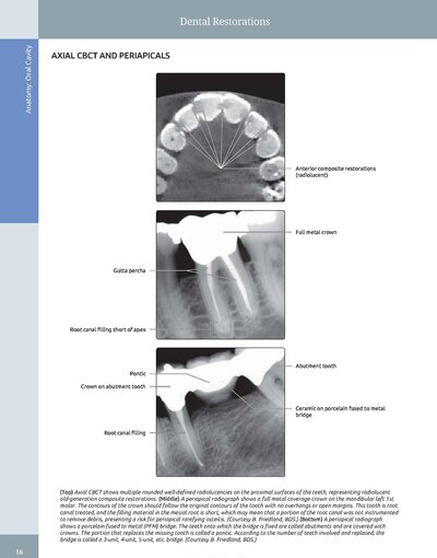 Diagnostic Imaging: Oral and Maxillofacial 3rd Edition