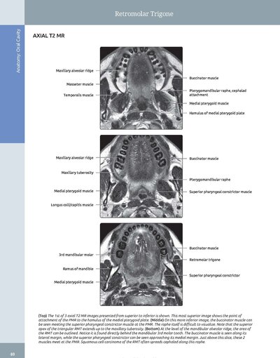 Diagnostic Imaging: Oral and Maxillofacial 3rd Edition