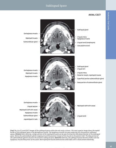 Diagnostic Imaging: Oral and Maxillofacial 3rd Edition