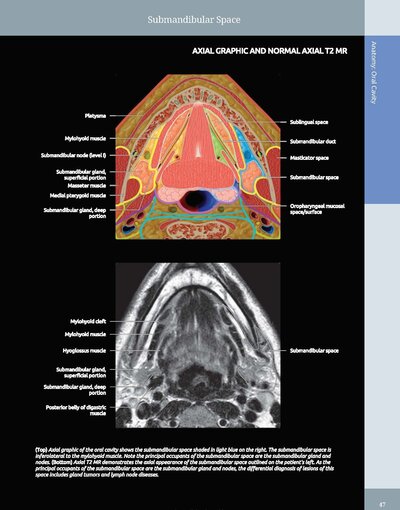Diagnostic Imaging: Oral and Maxillofacial 3rd Edition