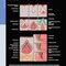 Diagnostic Imaging: Oral and Maxillofacial 3rd Edition