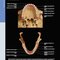 Diagnostic Imaging: Oral and Maxillofacial 3rd Edition