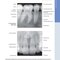 Diagnostic Imaging: Oral and Maxillofacial 3rd Edition