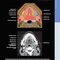 Diagnostic Imaging: Oral and Maxillofacial 3rd Edition