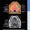 Diagnostic Imaging: Oral and Maxillofacial 3rd Edition