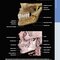 Diagnostic Imaging: Oral and Maxillofacial 3rd Edition