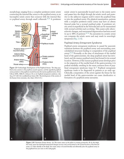 Rutherford's Vascular Surgery and Endovascular Therapy, 2-Volume Set