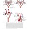 Rutherford's Vascular Surgery and Endovascular Therapy, 2-Volume Set