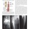 Rutherford's Vascular Surgery and Endovascular Therapy, 2-Volume Set