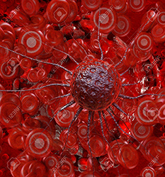 خون و سرطان - Hematology & Oncology