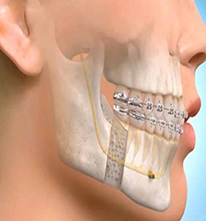 دندانپزشکی، جراحی فک و صورت - Dentistry & Maxillofacial Surgery